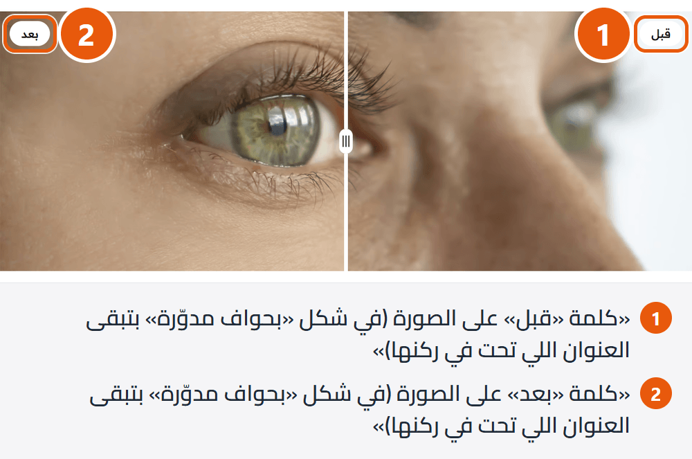 مقارنة قبل وبعد