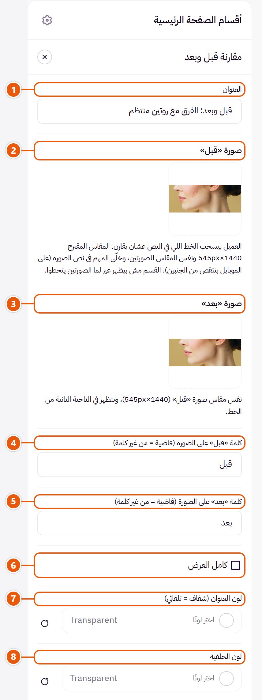 إعدادات «مقارنة قبل وبعد» في محرر زد (1 من 2)